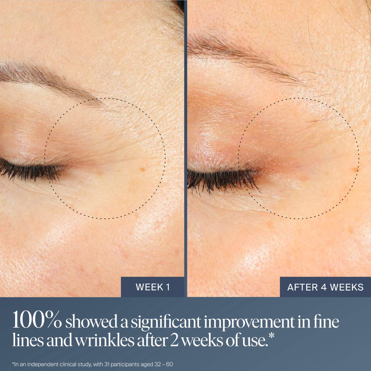 Jet Lag Overnight Eye Serum for Fine Lines & Wrinkles with Gentle Retinol Blend - Summer Fridays